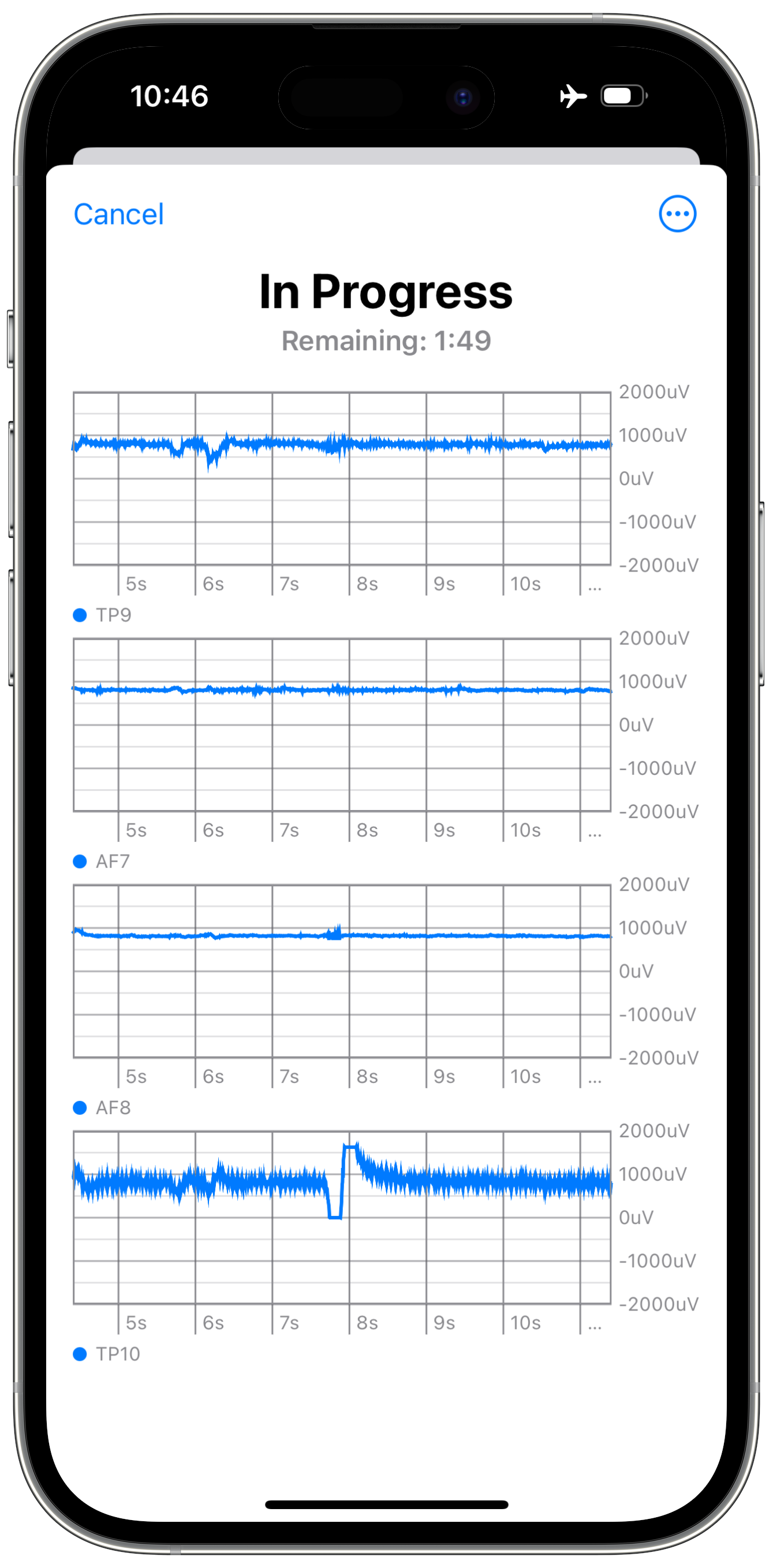 NeuroNest example showing an EEG recording in progress with four channels of waveforms.